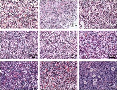 The dynamic expression of SOX17 in germ cells from human female foetus and adult ovaries after specification